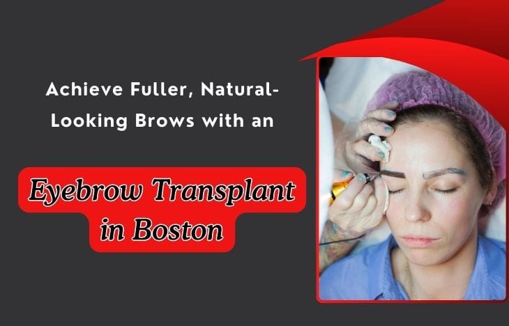 Eyebrow Transplant in Boston