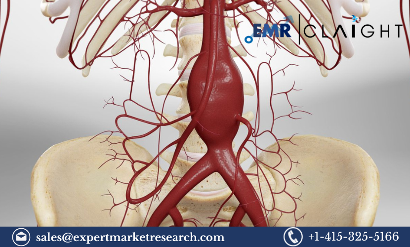 North America Aortic Stent Graft Market