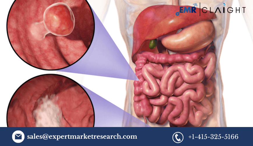 North America In-vitro Colorectal Cancer Screening Tests Market