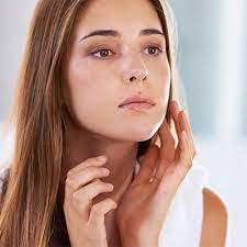 How To Manage Your Acne And Stay Acne Free?