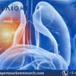 Non-Small Cell Lung Cancer Treatment Market