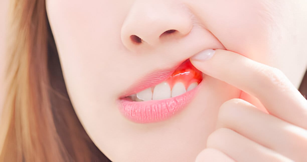 Comprehensive Guide to Gum Disease Treatments in Lubbock, Texas