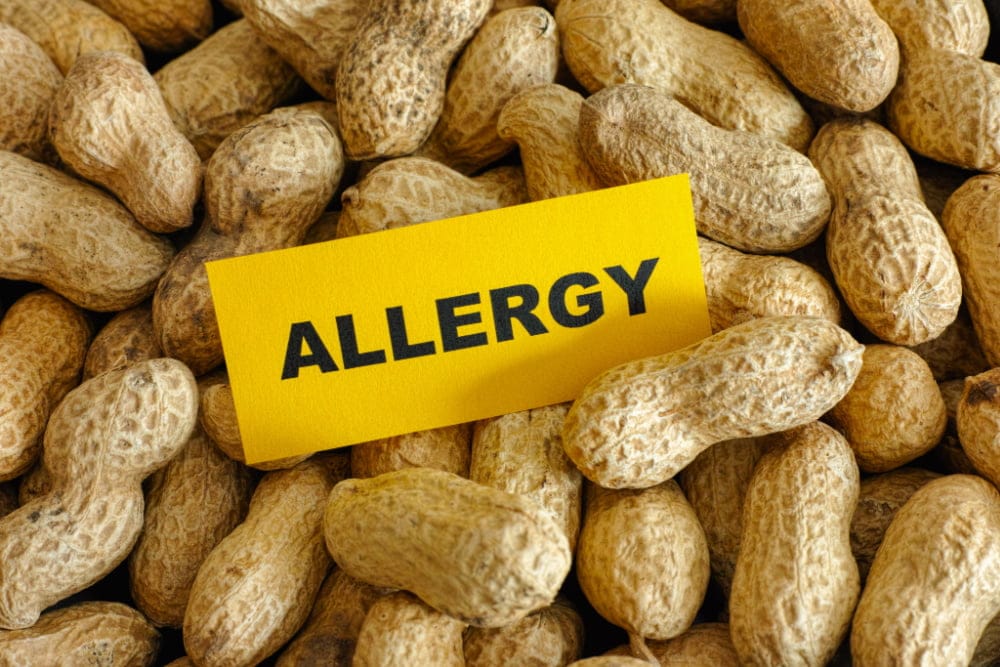 peanut allergy management