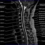 CT Head and Neck Sagittal Labeling